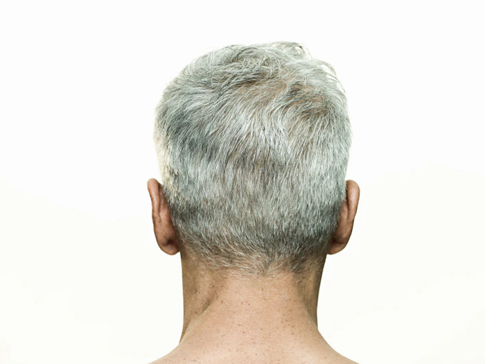 Cabelo Branco: Causas, Como Disfarçar, Como Evitar e mais